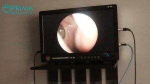 Эндоскопическое исследование полости носа/носоглотк?