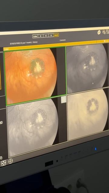 От наших врачей не ускользнет ни одна деталь сетчатке! смотреть онлайн