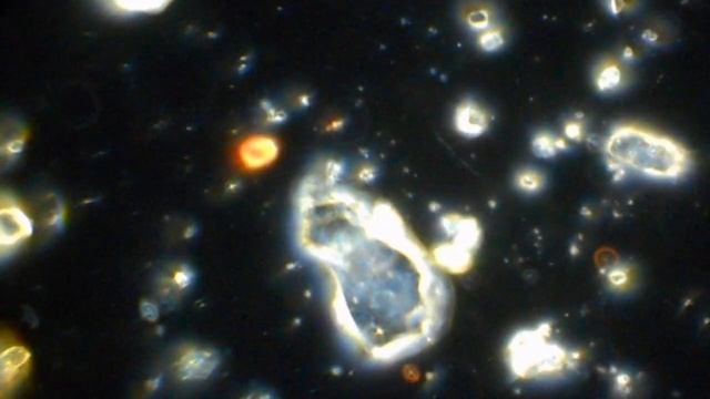 Живий пил з Сахари, мікроскопія темного поля.