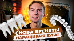 Снова брекеты. Наращиваю зубы