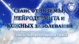 Сеанс от ЭКЗЕМЫ, нейродермита и КОЖНЫХ заболеваний (Сеанс 97). Орис Орис