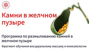 Камни в желчном пузыре. Программа по размыливанию камней в желчном пузыре