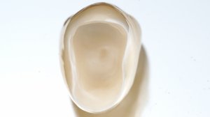 ВЕРТИКАЛЬНОЕ ПРЕПАРИРОВАНИЕ | ПОДГОТОВКА К ФИКСАЦИИ | ПЕСКОСТРУЙ