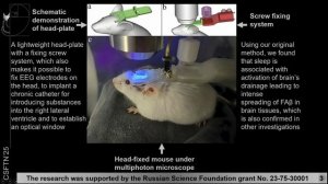 A Method for Real-Time Brain Imaging in Unrestrained Mice Across Sleep-Wake States