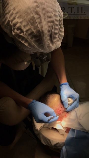 Забор графтов смотреть онлайн