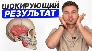 ОДНО УПРАЖНЕНИЕ для челюсти 3 МИНУТЫ в день = УПРУГОЕ ЛИЦО / Как быстро подтянуть овал лица?