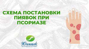 Гирудотерапия при псориазе