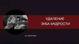 УДАЛЕНИЕ ЗУБА МУДРОСТИ