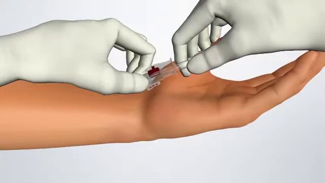 Arterial Cannula артериальная канюля с защитным устройством