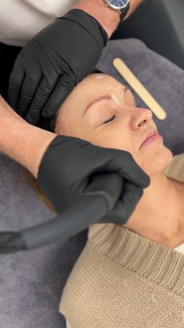 NeoGen плазменное омоложение