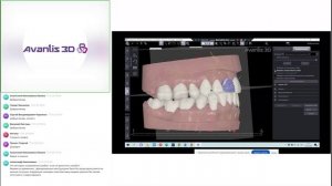 Способы контроля реконструктивного прикуса на этапах ортопедического и ортодонтического лечения