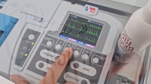 Наложение ЭКГ