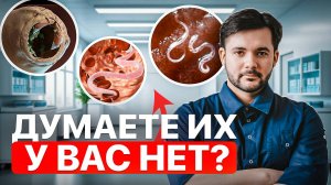 Топ 5 Признаков, Что В Тебе Живут Паразиты. Как Вывести из ОРГАНИЗМА ПАРАЗИТОВ