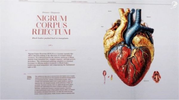IDOMED - Nigrum Corpus (case study)