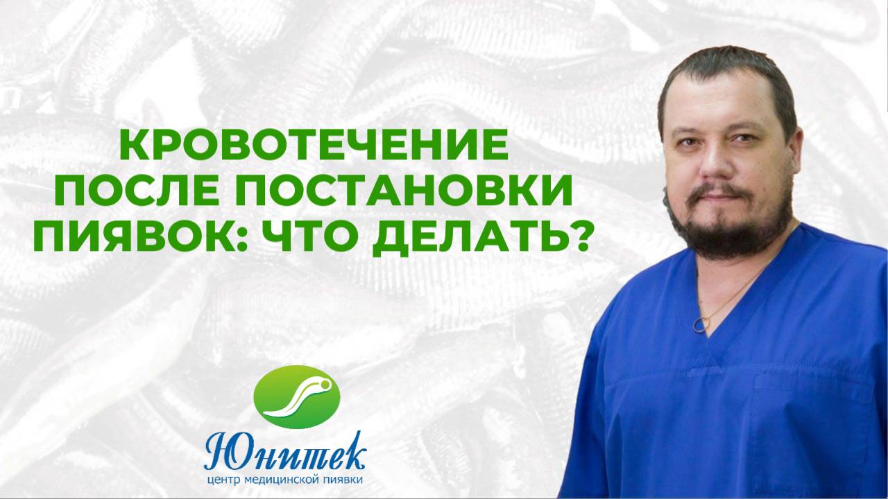 Кровотечение после постановки пиявок: что делать?