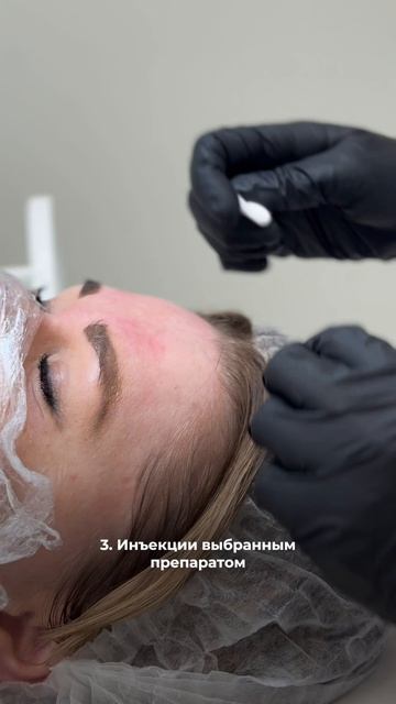 Как проходит процедура биоревитализации?