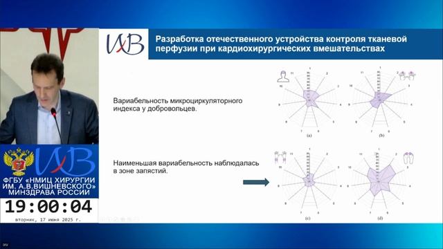 Служба анестезиологии и реаниматологии НМИЦ хирургии им. Вишневского: взгляд из прошлого в настоящее