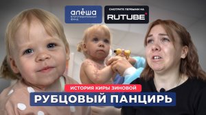 РУБЦОВЫЙ ПАНЦИРЬ | История Киры Зиновой