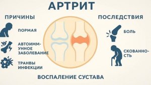 «Артрит, артроз и другие болезни суставов — что нужно знать»
