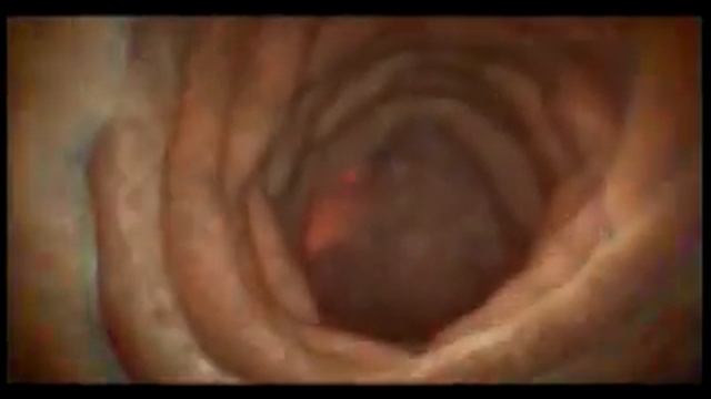 Профилактика алкоголизма "Береги себя!" смотреть онлайн