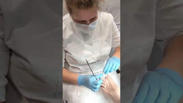 ТАМПОНАДА КОПОЛИНОМ