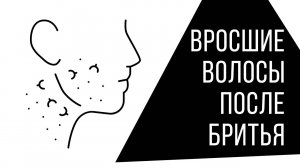 Вросшие Волосы: Мой Опыт и Научные Факты. Как Бриться Без Проблем?