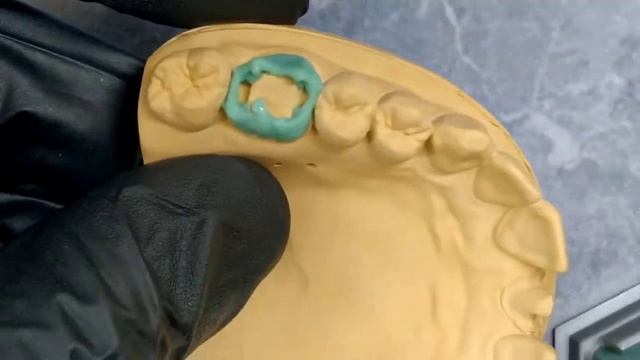 Ваксап_ Моляр.