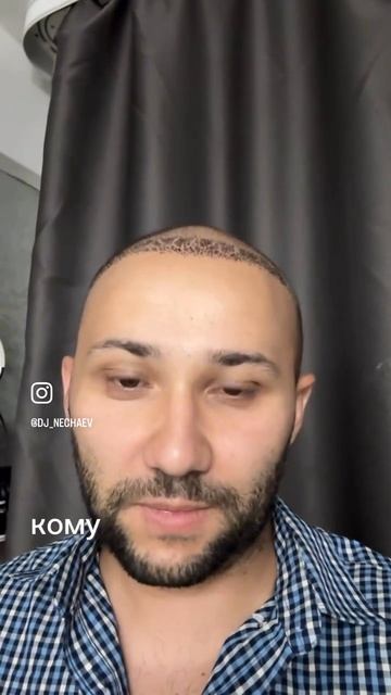 Пересадка волос 18+ смотреть онлайн