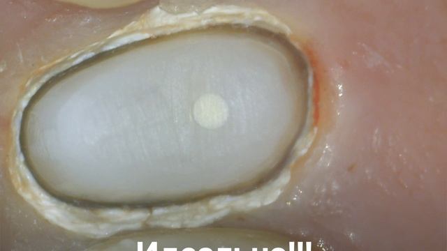 Удаляем или сохраняем