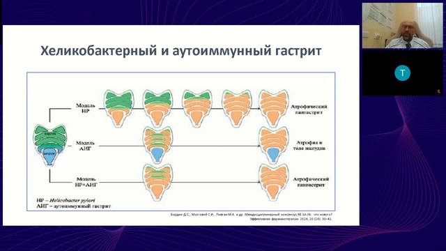 ГастроПанель - в практике терапевта и гастроэнтеролога смотреть онлайн