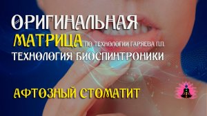 Афтозный стоматит ⚠️ Оригинальная матрица по технологии Гаряева П.П ☀️ SoftRadio.ru
