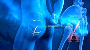 Сайт Гаряев-Матрицы.РФ Архив: Чистая матрица Гаряева П П  Ишиас Чистая матрица Гаряева П П