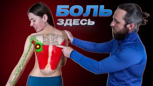 Из-за этого БОЛИТ СПИНА, ЛОПАТКА, ПЛЕЧО и РУКА