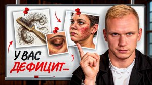 Нет ЭНЕРГИИ, выпадают ВОЛОСЫ, плохая КОЖА, ОТЕКИ — у вас дефицит ЭТОГО микроэлемента