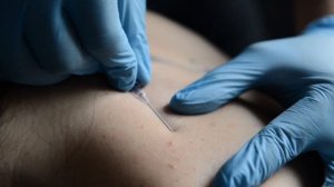 Иглонож / Т-игла