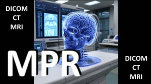 Мини-обзор // Функции WEASIS // Мультипланарная реформация MPR