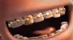 Теркель в беде - Репак