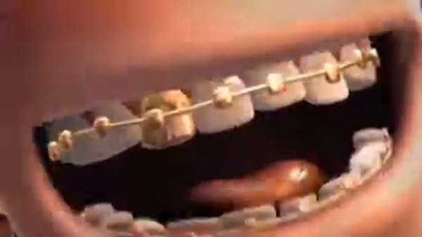 Теркель в беде - Репак