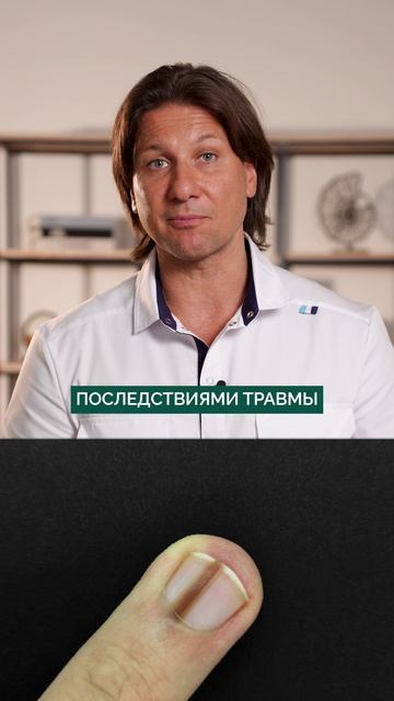 СРОЧНО посмотрите на свои ногти! #организм #здоровье #ногти смотреть онлайн