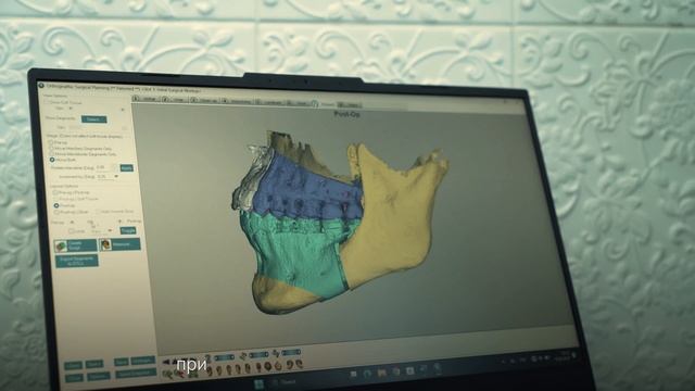 Ортогнатическая хирургия. Челюстно-лицевой хирург Александр Маковский смотреть онлайн