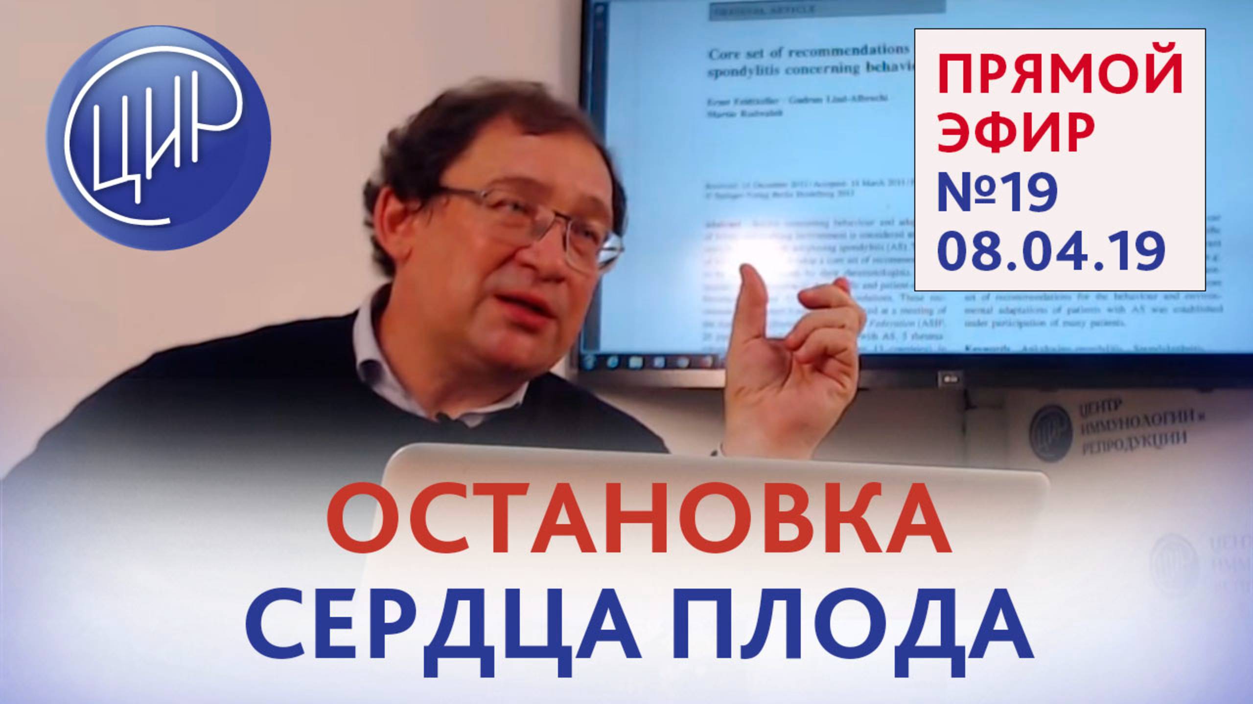 Аутоимунный синдром и нарушения со стороны сердца плода. Болезнь Бехтерева и беременность. Эфир 19.