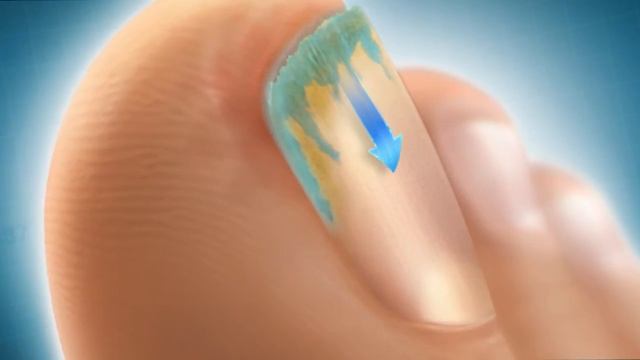 Ekzoderil TVC смотреть онлайн