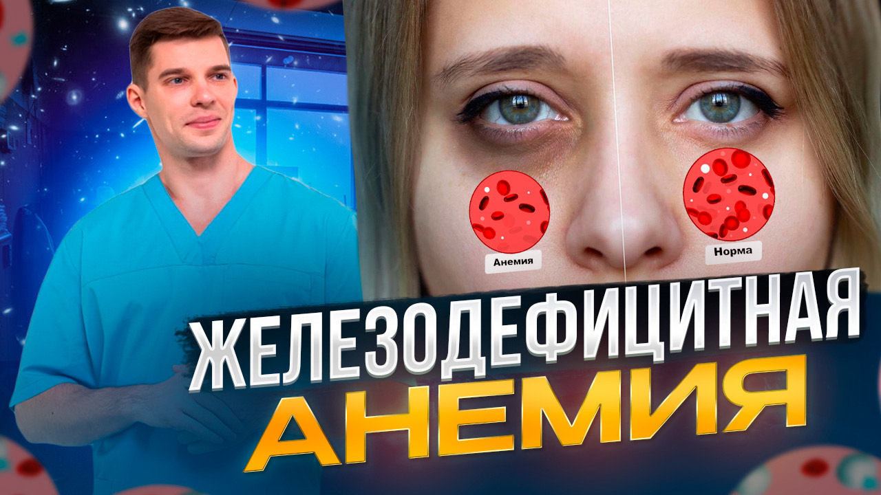 Железодефицитная анемия. Симптомы. Анализы. Лечение. смотреть онлайн
