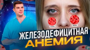 Железодефицитная анемия. Симптомы. Анализы. Лечение.