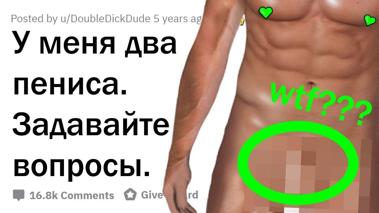 Шок: у меня два пениса — отвечу на все ваши вопросы!