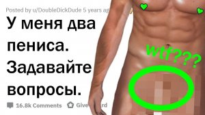 Шок: у меня два пениса — отвечу на все ваши вопросы!
