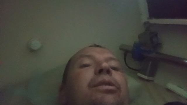 Рассеянный склероз. смотреть онлайн