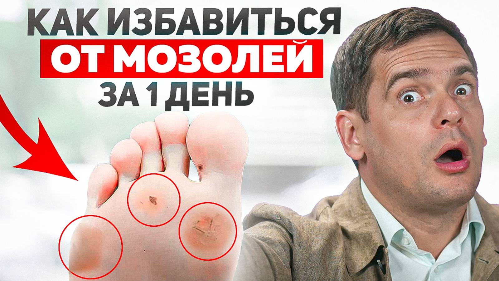 3 действия НАВСЕГДА избавят от НАТОПТЫШЕЙ и СТРЕЖНЕВЫХ МАЗОЛЕЙ! смотреть онлайн