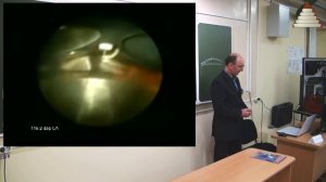 СТАРТ_07_Сгорание и угол опережения зажигания