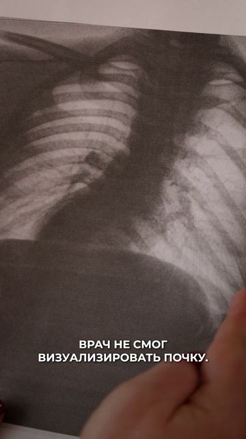 Лечения нет... смотреть онлайн